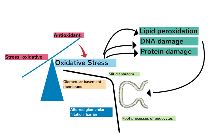 The role of oxidative stress in hypoalbubimenia nephropathy related to Nephrotic syndrome: a critical review 