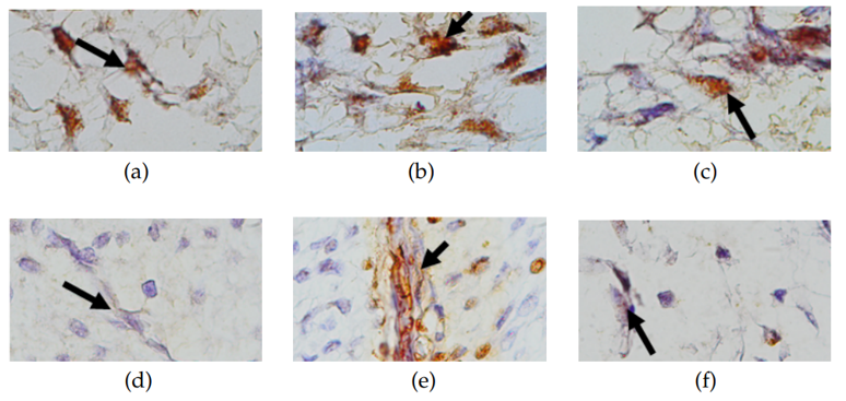 Expression of mapk and nav-1.8 in nerve cells in normal and inflamed pulp after dental pulp tissue extirpation 