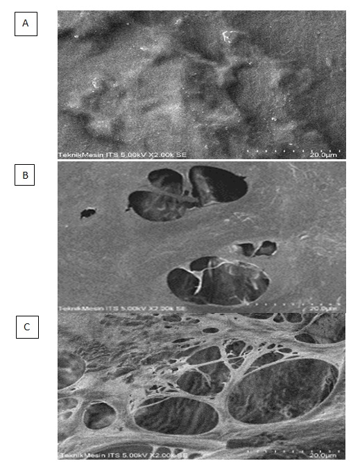 ASB-16 was superior to SDS 0.5% as a decellularization agent: An in vitro study using bovine pericardium