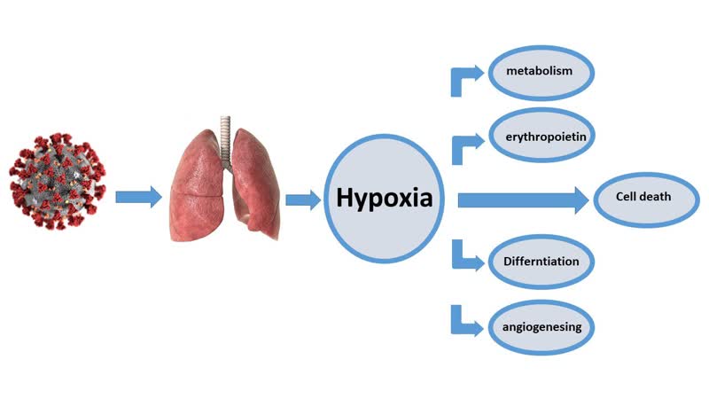Exploring the clinical implications of silent hypoxia in COVID-19 